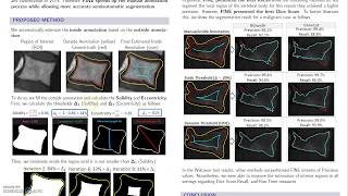 FINE: Improving time and precision of segmentation techniques for VCFs in MRI (SAC2020)