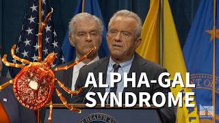 RFK Jr. says there's been a surge in alpha-gal syndrome cases from Lone Star ticks