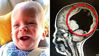 Ребенок родился «без мозга»… 3 года спустя врач проводит исследование и обнаруживает…