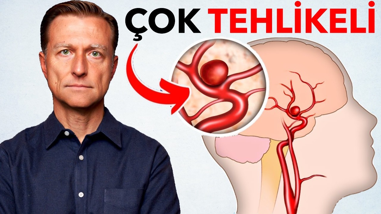 Anevrizmalar (Damar Balonlaşması): Sessiz Katil | Dr. Berg Türkçe
