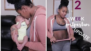 2 WEEK POSTPARTUM UPDATE| SYMPTOMS, PAIN + BELLY SHOT!