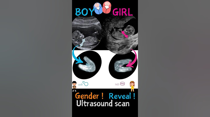 Ultrasound | baby boy v baby girl #ultrasound #pregnancy #babyboy