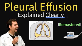 Pleural Effusions  Causes, Diagnosis, Symptoms, Treatment