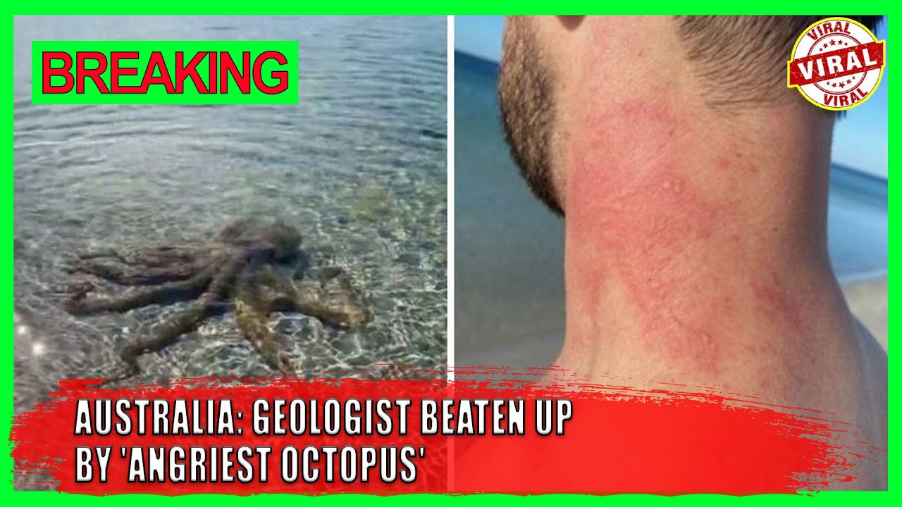 Australia: Geologist beaten up by 'angriest octopus' on beach