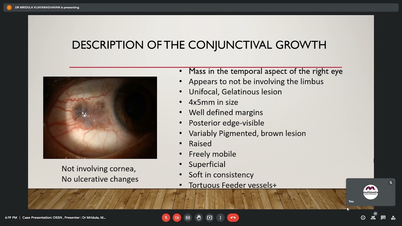 Case Presentation OSSN, Dr. Mridula Vijayaraghavan, 22 Nov 2021