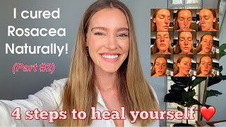 I cured Rosacea naturally in 4 steps | Part 2 | Georgia Gibbs