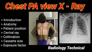 Chest PA View X-Ray # Posterior to Anterior view #  part -1 #  || By BL Kumawat #