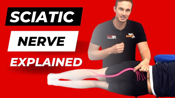 What is Sciatica and What Causes it? Sciatica Explained by a Physiotherapist.