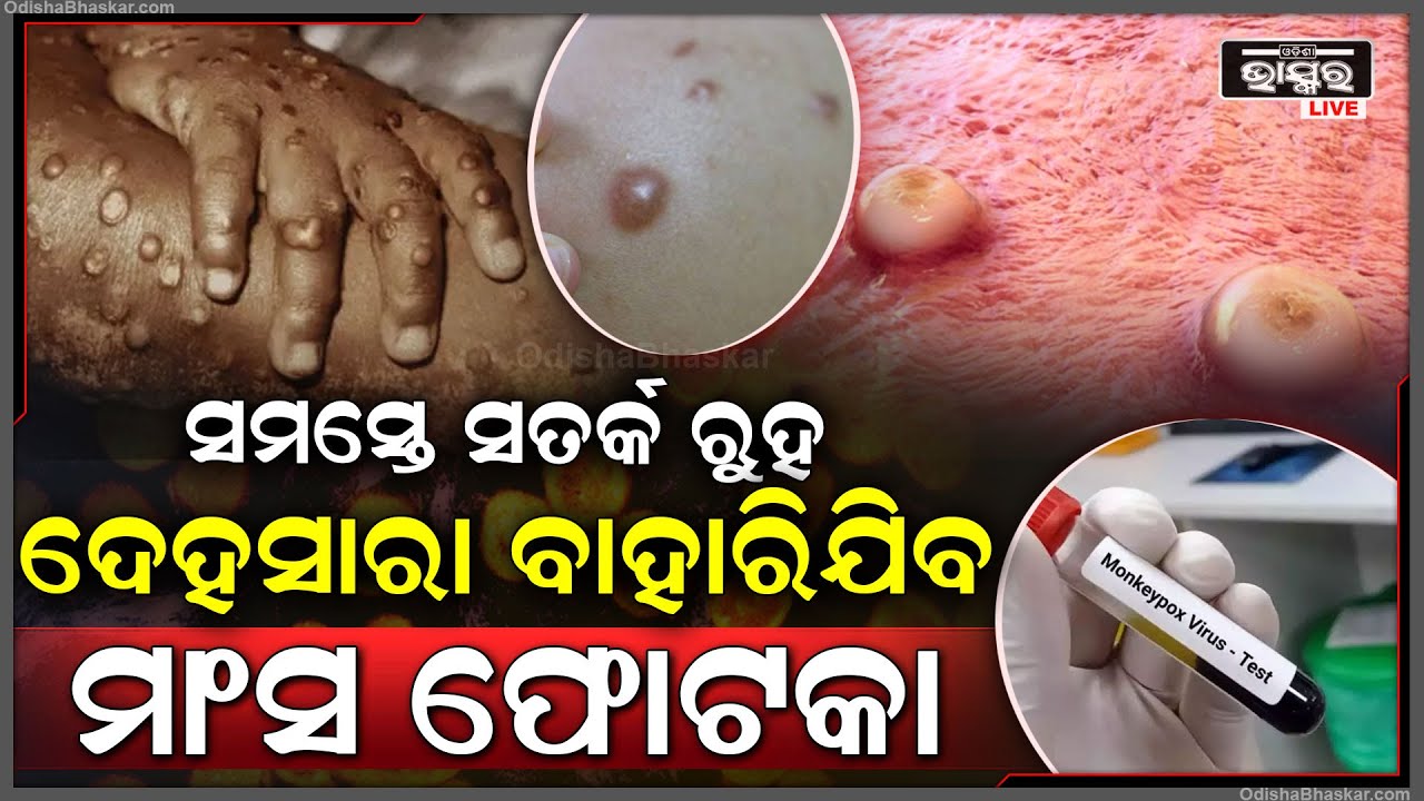 ହୋଇଯାଆନ୍ତୁ ସାବଧାନ୍ ! ଭାରତରେ ବାହାରିଲା ମଙ୍କିଫକ୍ସ | ରାଜ୍ୟମାନଙ୍କୁ କଡ଼ା ନିର୍ଦ୍ଦେଶ ଦେଲା କେନ୍ଦ୍ର ସରକାର