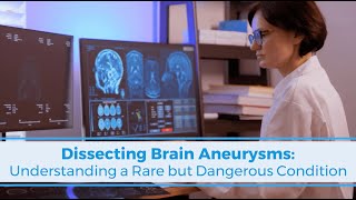 Dissecting Brain Aneurysms: A Rare But Dangerous Condition