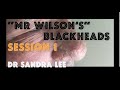 Part 1: "Mr Wilson" Extracting large blackheads. For medical education- NSFE.