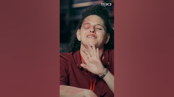 כל הגירודים מהפרק עקיצות 😮 | מתוך קופה ראשית עונה 3 #shorts