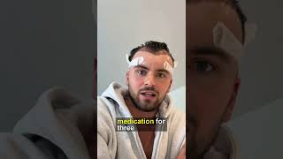 Ty Isherwood's Shocking Hair Transformation Story!
