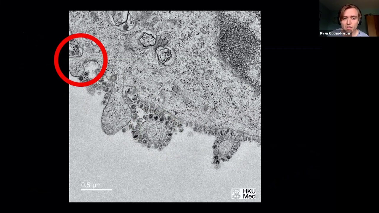 Virus 101 and COVID-19 - Ryan Ridden-Harper