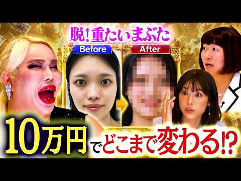 【総額10万円!?】3つの施術で別人級の美女へ。アレン様が認めた衝撃のビフォーアフター【美の暴走劇場#10】