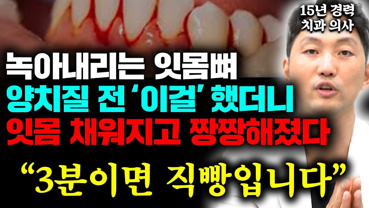 피나는 잇몸병에 양치질 보다 '이것' 먼저 하면 잇몸 되살아나고, 잇몸 튼튼해집니다 (안상수 원장 통합)