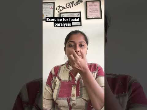 Exercise For Facial Paralysis | Bell’s Palsy | Facial Palsy | Nerve Compression | Dr.Maitri Kothari