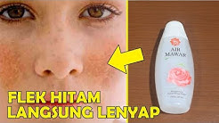 TIDAK PERLU PERAWATAN MAHAL, BEGINI CARA MENGHILANGKAN FLEK HITAM DALAM WAKTU SINGKAT || SEHAT TUBE - Durasi: 3.14. TIDAK PERLU PERAWATAN MAHAL, BEGINI CARA MENGHILANGKAN FLEK HITAM DALAM WAKTU SINGKAT || SEHAT TUBE - Durasi: 3.14.