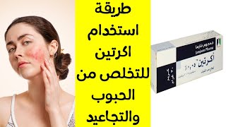 كريم اكرتين وطريقة استعماله لعلاج حب الشباب ( طريقة استخدام اكرتين لتقشير الوجه وإزالة التصبغات )