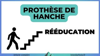 Prothese de hanche : rééducation vue par une kiné