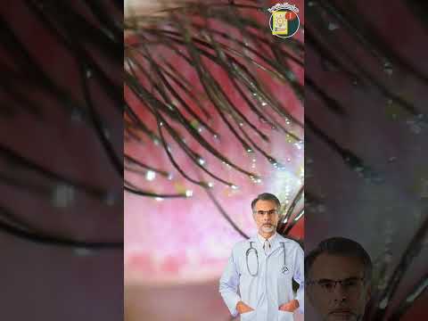 كائنات تعيش على وجه كل انسان 