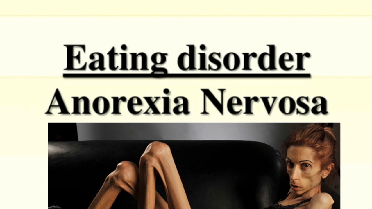 Anorexia Nervosa & its Types YouTube