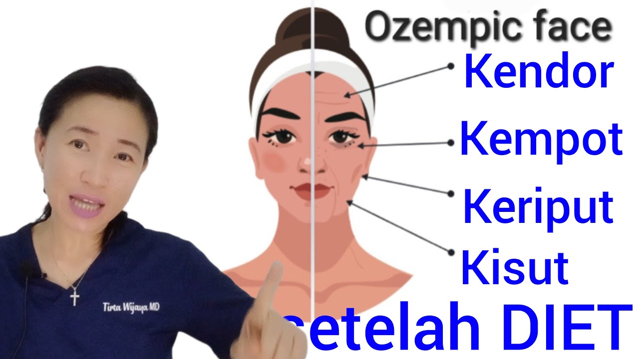 Kulit kendor kempot keriput kisut setelah diet??? @dr.tirtawatiwijaya
