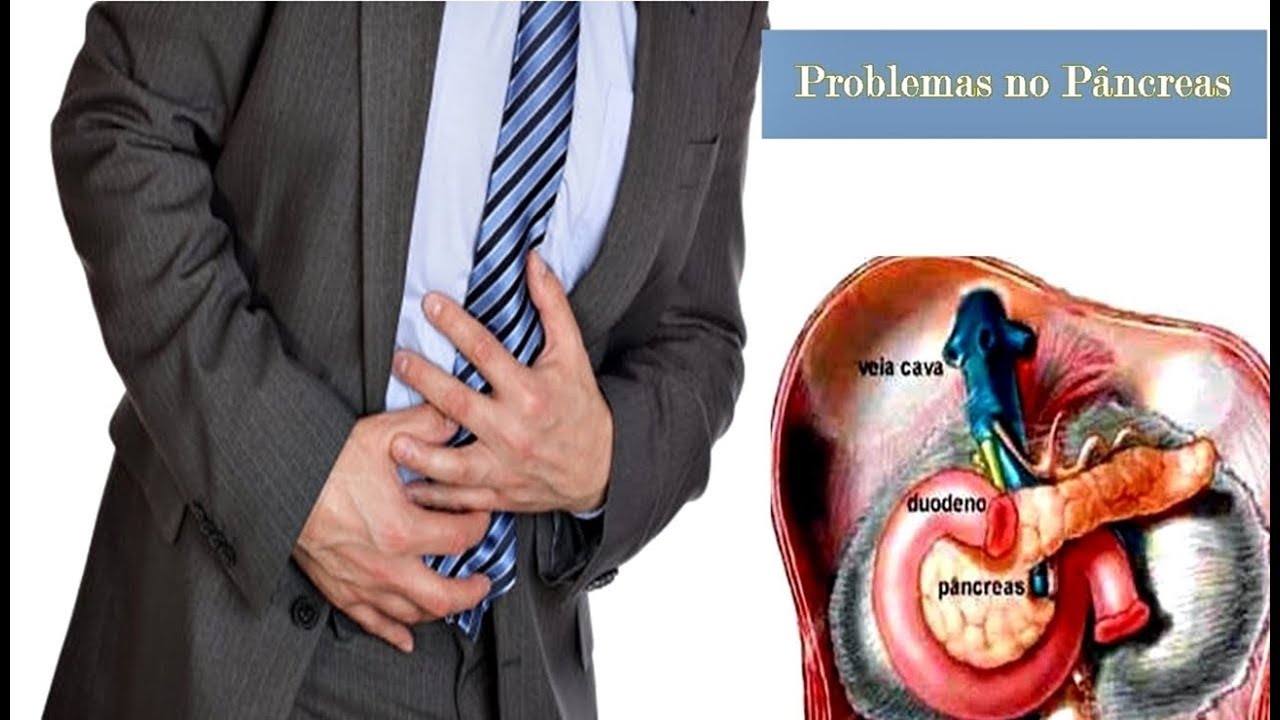 Sintomas Problema No Pâncreas - NAZAEDU