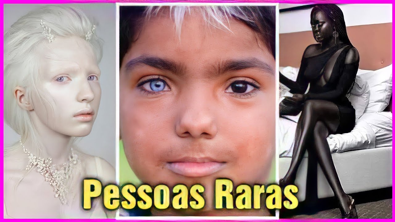 Top 11 Seres Humanos Raros que são um em um Milhão - YouTube