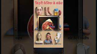 Kidney failure signs #shortsvideo #gk