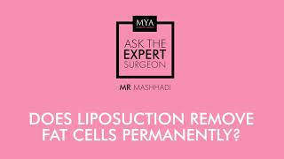 Does Liposuction Remove Fat Cells Permanently? || Ask The Expert Surgeon