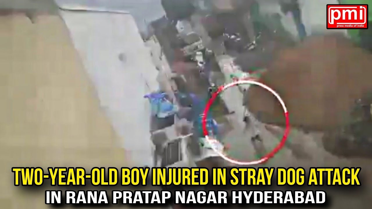 Two-year-old Boy Injured In Stray Dog Attack In Hyderabad | PMI NEWS ...