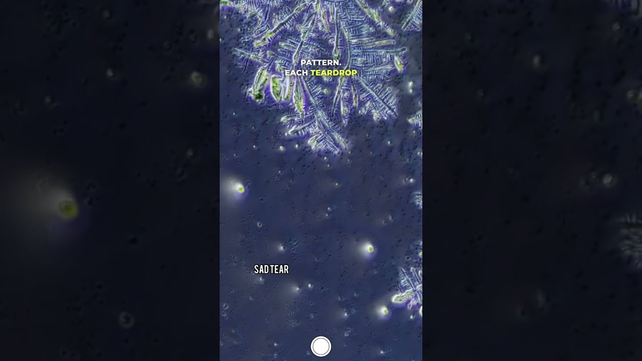 Sad VS Happy Tears Under Microscope Science Microscopy