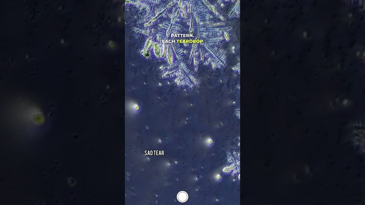 Sad VS Happy Tears Under  Microscope #science #microscopy #microscope