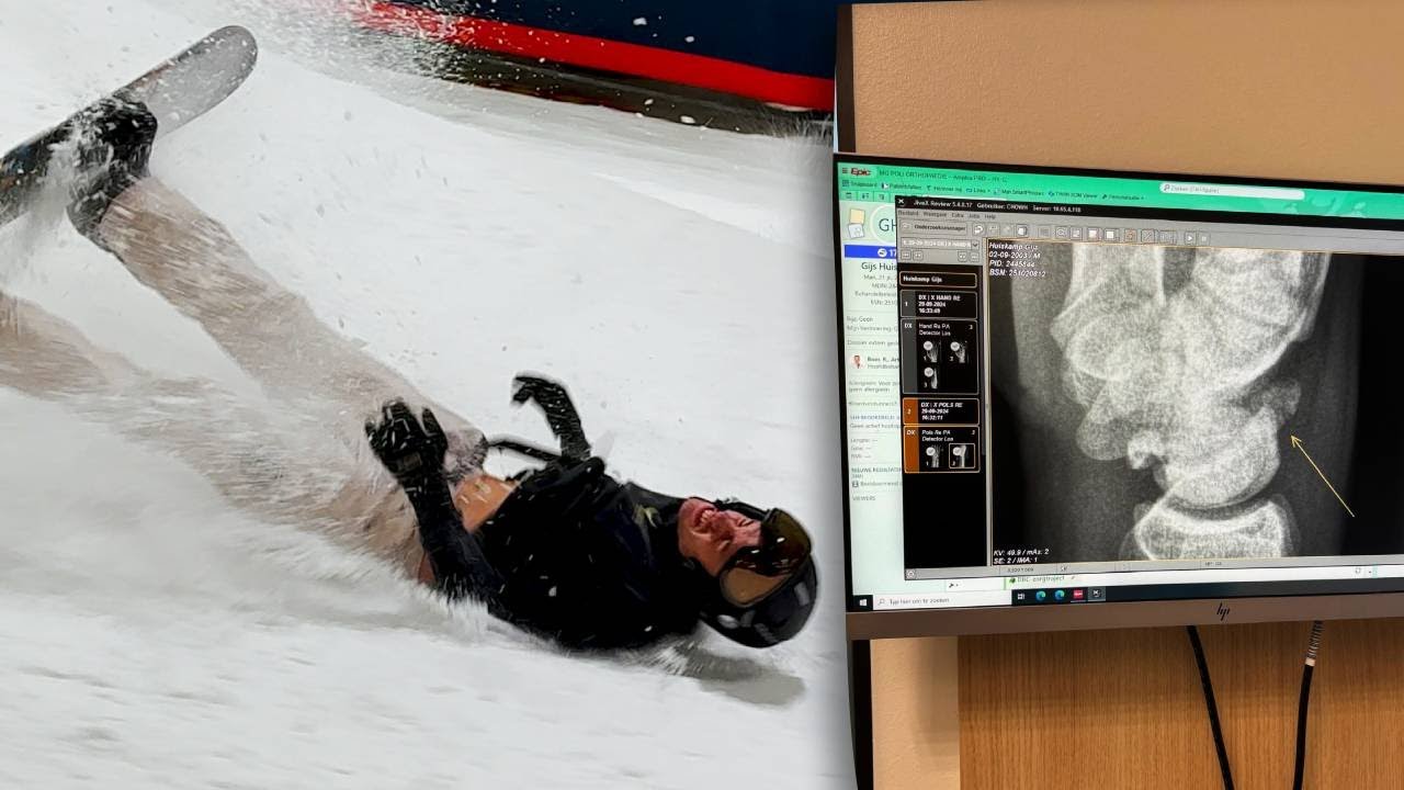 GIJS BREEKT HAND BIJ SNOWBOARD TRUC