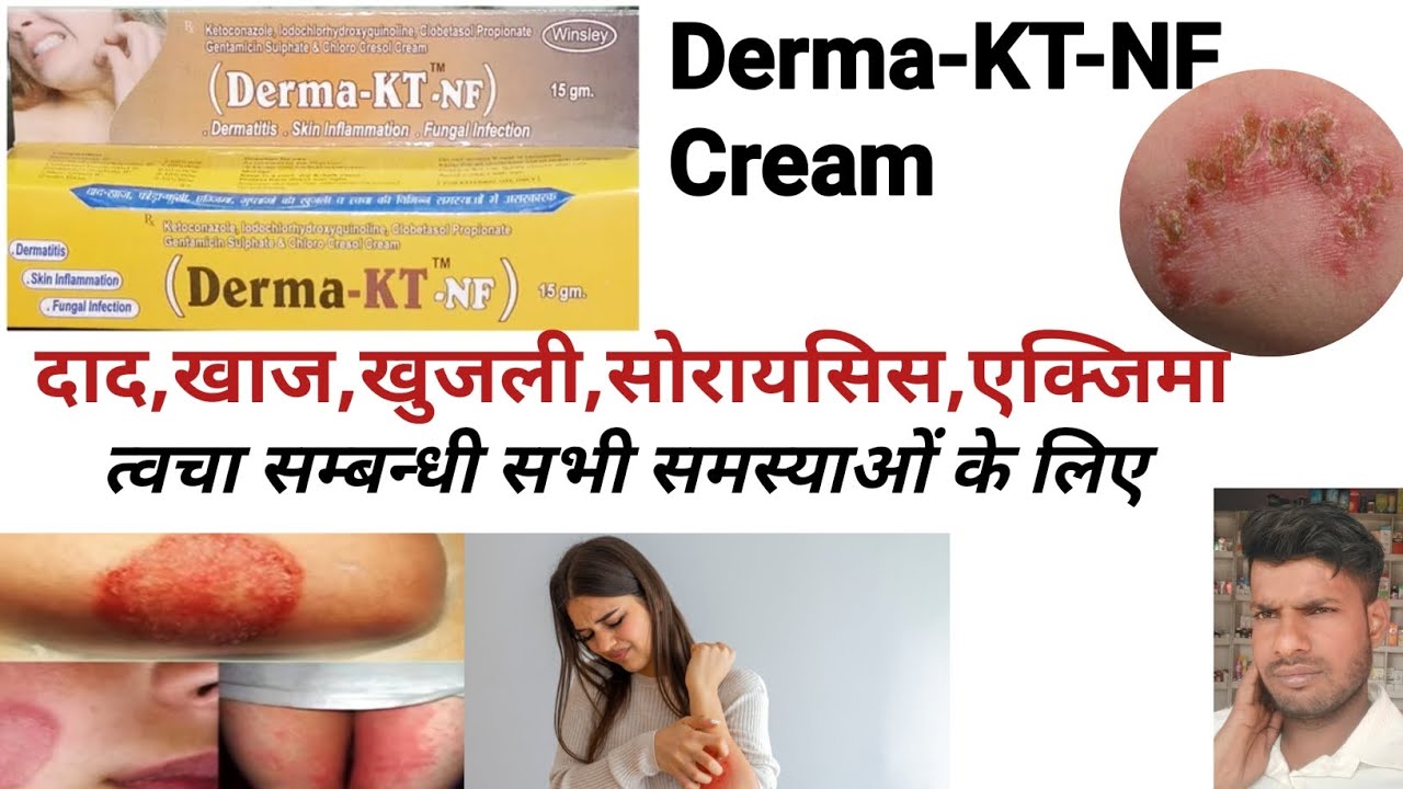 Derma-KT-NF Cream | Derma-KT-NF Cream Uses in hindi | दाद,खुजली | त्वचा सम्बन्धी सभी समस्याओं के लिए