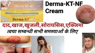 Derma-Kt-Nf Cream Derma-Kt-Nf Cream Uses In Hindi दद,खजल तवच समबनध सभ समसयओ क लए