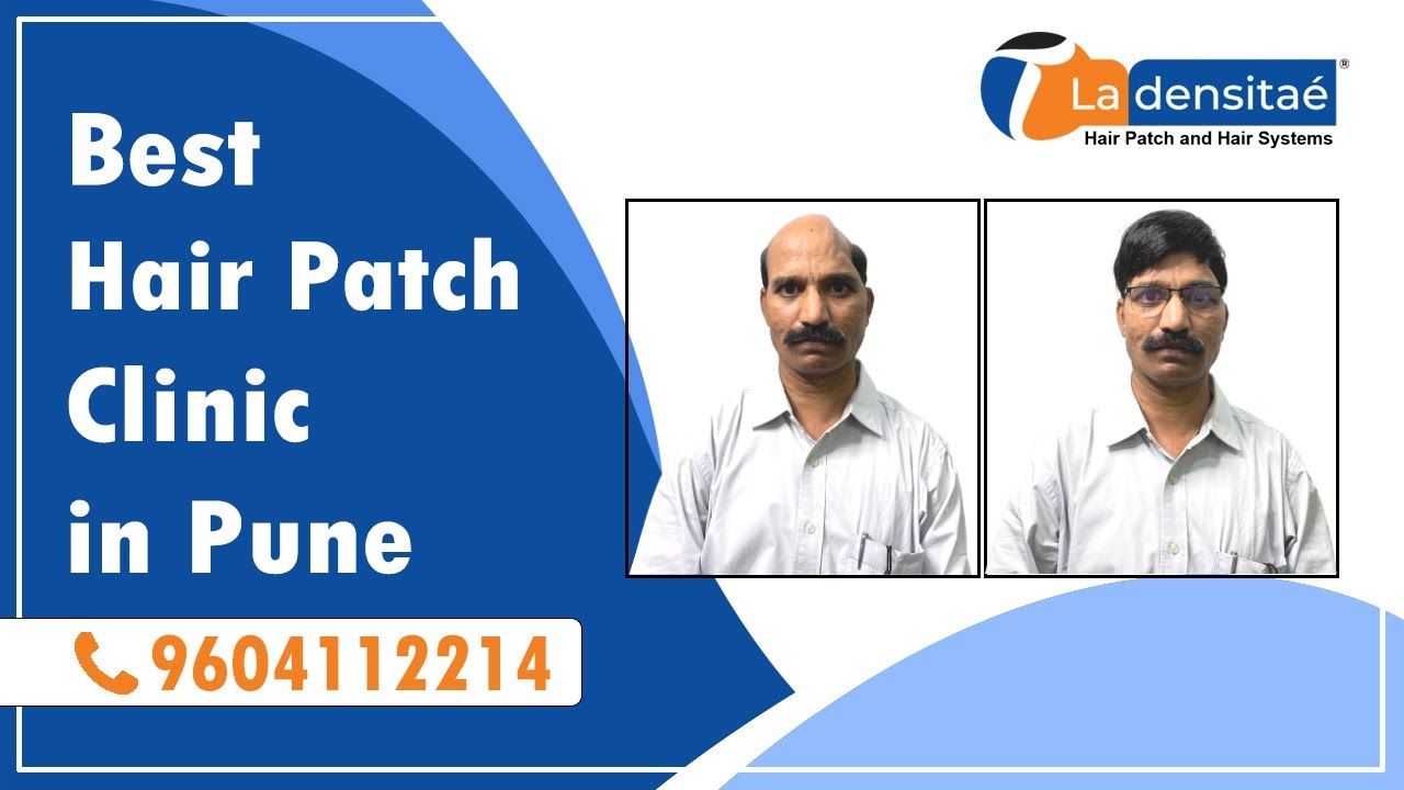 Best Hair Patch in Pune  PCMC  Low Cost