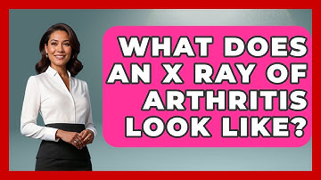 What Does An X Ray Of Arthritis Look Like? - Orthopedic Support Network