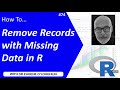 How To... Remove Records with Missing Data in R #74 Mp3 Song