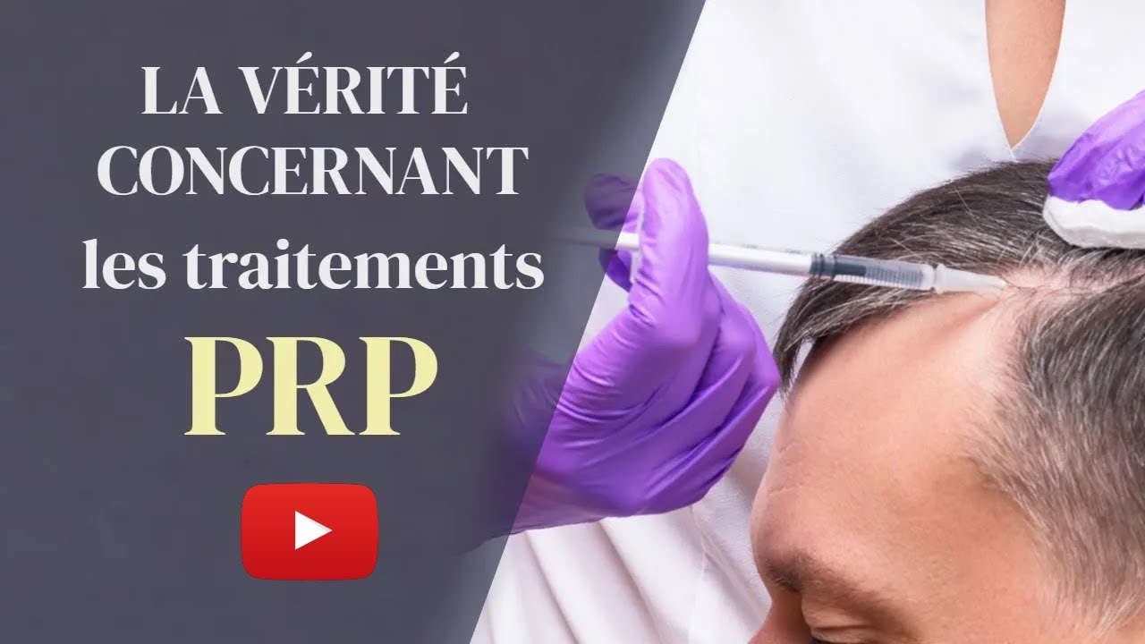 Traitement capillaire PRP [Arrêter la chute des cheveux pour toujours ?]