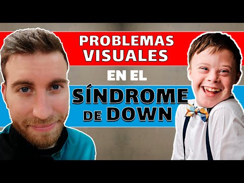 Vídeo: Un Niño De Siete Años Con Síndrome De Down Tomó Una Foto De Su 
