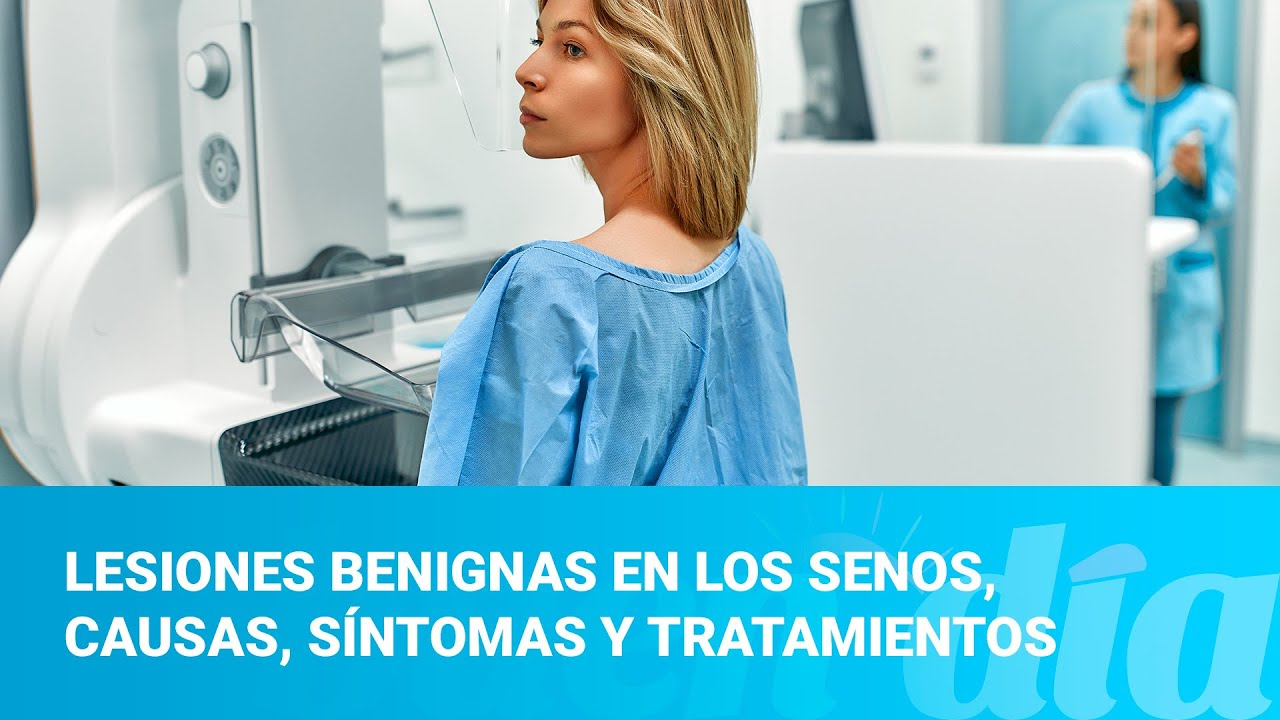 Lesiones benignas en los senos, causas, síntomas y tratamientos