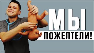 ЖЕЛТУХА НОВОРОЖДЕННЫХ | Лечение ЖЕЛТУХИ у младенцев на ДОМУ