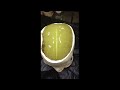 Adult Head Hematoma Feature