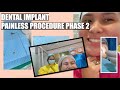 Second Phase Dental Implant Procedure | Fast and Painless | Apostol Dental Philippines