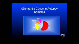 Understanding Behavioral Challenges in Lewy Body Dementia