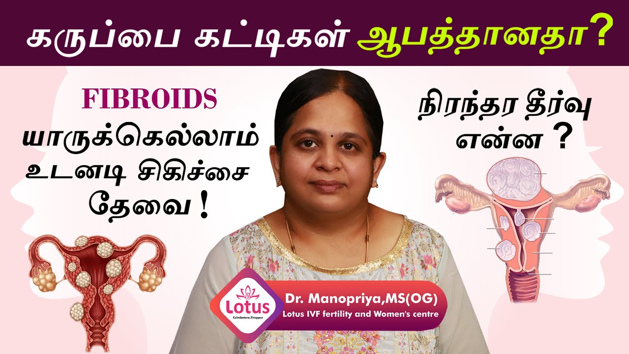 Fibroids: Causes, symptoms, and treatments|கர்பப்பை கட்டி அறிகுறிகள் மற்றும் சிகிச்சை முறைகள் என்ன ?