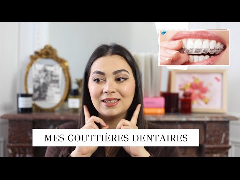 Vidéo: Pourquoi les gouttières sont-elles nécessaires ?