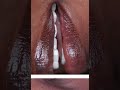 YOUTUBE TITLEElite Aesthetic Medicine, Plastic Surgery & Longevity: Smile Infinity Beirut
